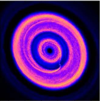 Rings and Gaps in a Developing Planetary System